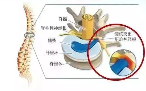 老人口热气是什么原因_热气籽是什么样子(2)