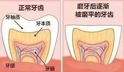 为什么有人睡觉会磨牙?果真是肚子里有蛔虫?答案在这里