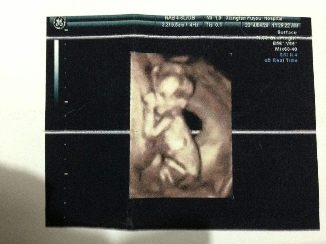 我们都知道怀孕三个月的时候,胎儿基本上已经长成人形,这个时候女宝宝