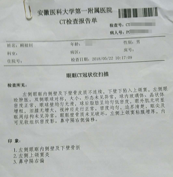 报告单显示,顾祖钊左侧眼眶内侧壁及下壁骨折,左侧上颌窦炎,鼻中隔右