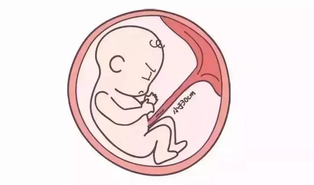 小baby与脐带之间的联系孕妈妈们知多少