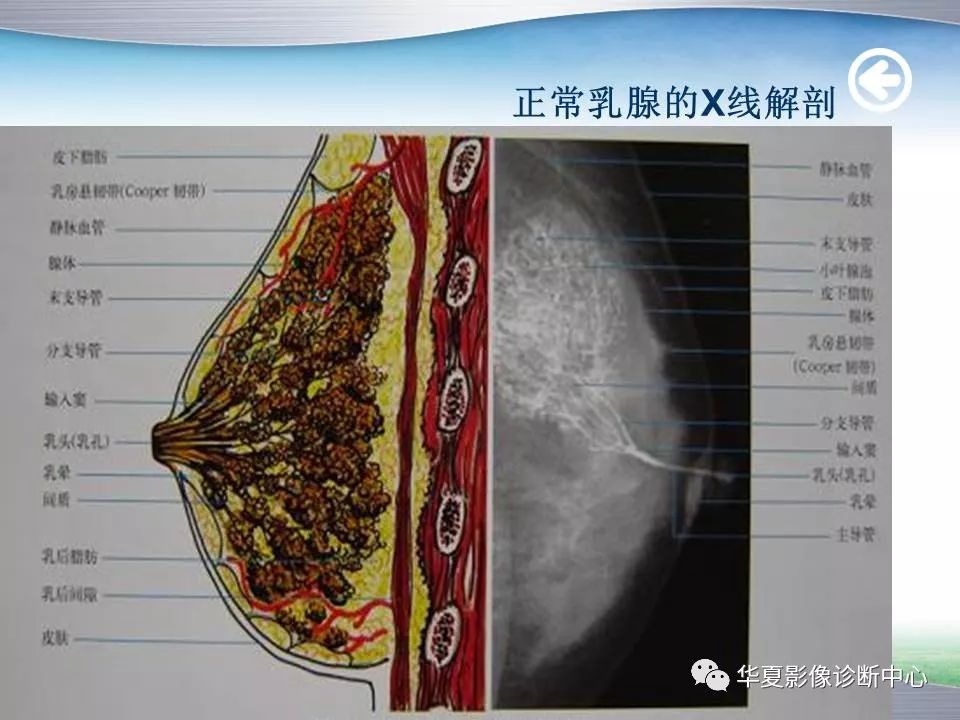 乳腺x线技术与诊断包括检查方法乳癌筛查指南birads报告系统常见病x