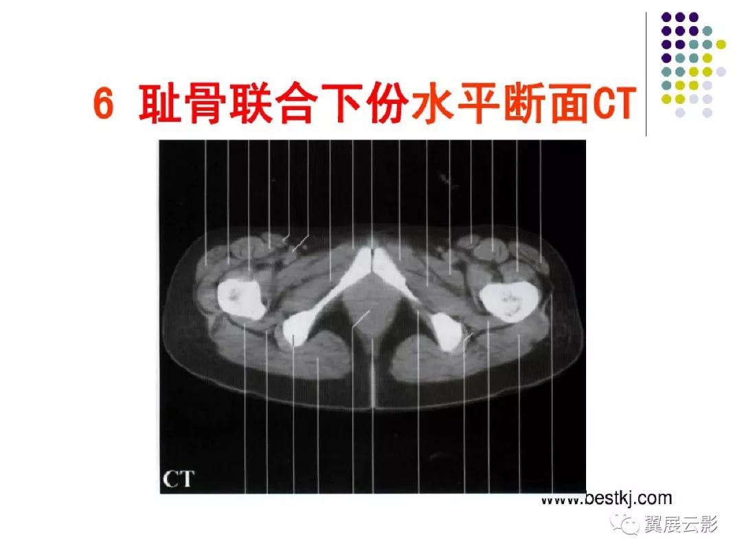 239.女性盆腔器官 (上面观)-基础医学-医学
