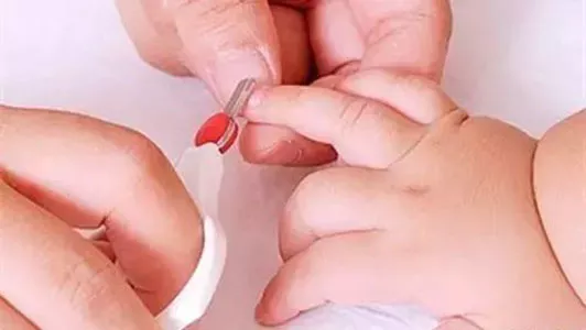 乱给宝宝剪指甲后果很严重!10个妈妈9个都剪错了!