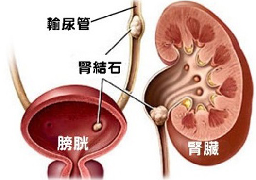 夏季如何防范男性疾病?