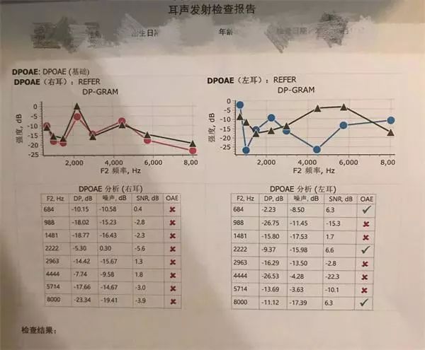 噪声敏感者(上岗前职业健康体检纯音听力检查各频率体力损失均≤25db