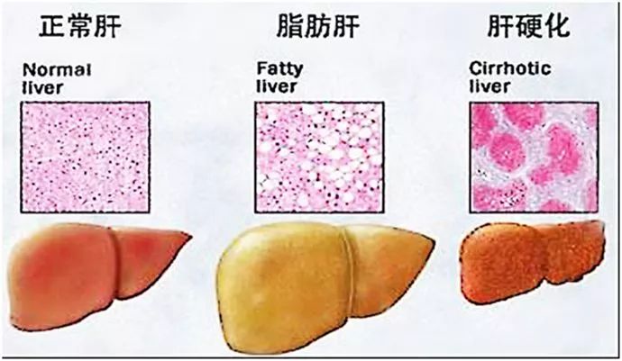 临床消化系统这样学,想不拿高分都难(纯干货分享)