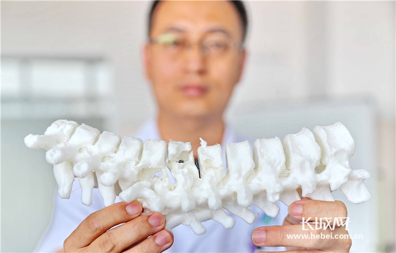 3d打印技术助秦皇岛患者完成复杂胸椎矫形手术