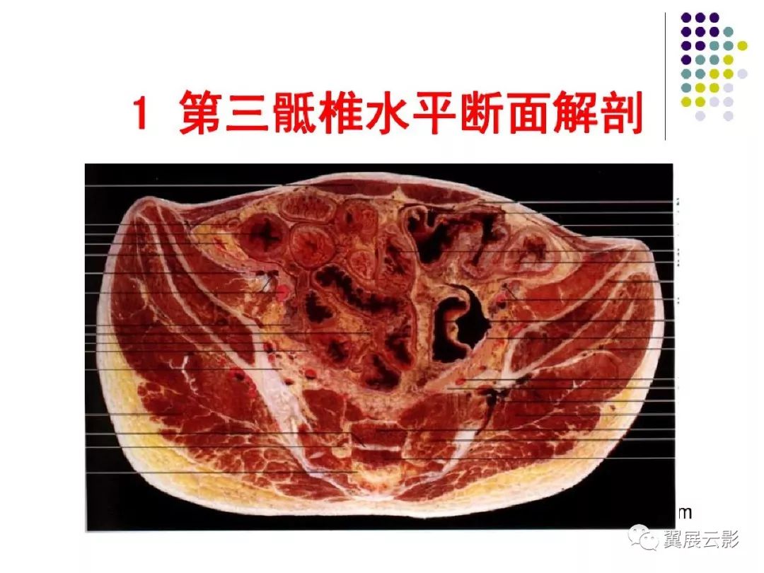 女性盆腔断层解剖及ct-图库-五毛网