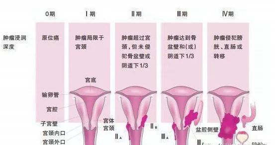 奇怪!王阿姨的"菜花"怎么不见啦?