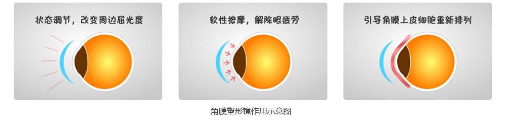 8岁近视300度怎么办