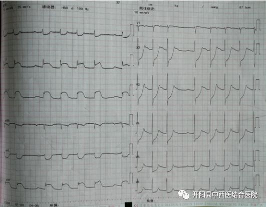 开阳县城人口_开阳县城图片(3)