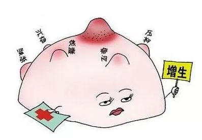 乳腺增生,你自己能摸出来!