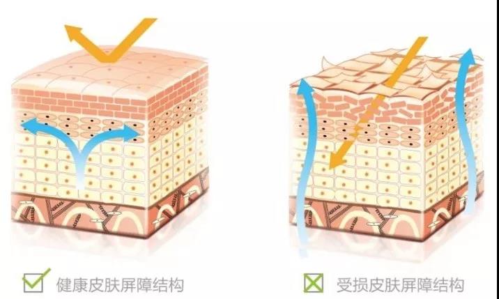 脸部水油不平衡怎么办