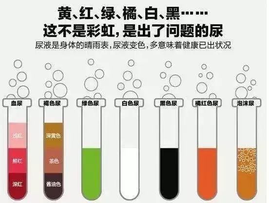 健康小贴士注意尿的颜色隐藏你的疾病信号请赶紧对照