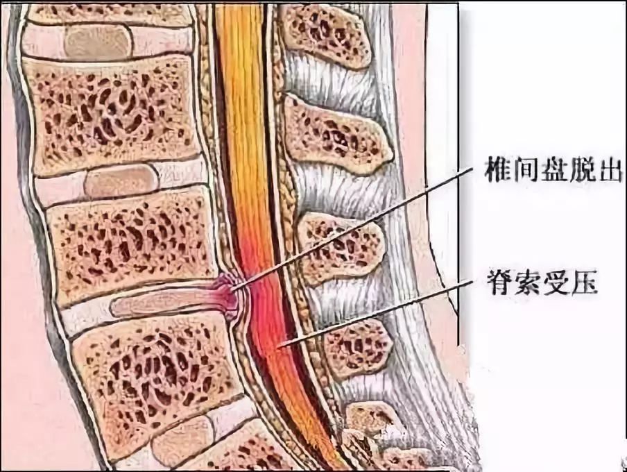 膀什么腰什么成语_牛膀是牛的什么(2)