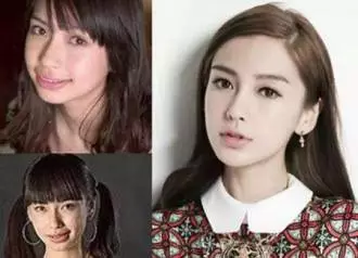 再看看angelababy,高圆圆,据称都只是矫正了牙齿