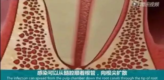 小孩子长牙包怎么办