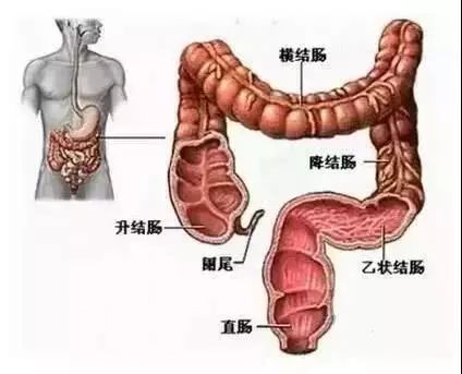 常常想要上厕所,实际坐在马桶上又解不出来,这是直肠癌的常见症状之一