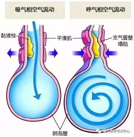 潮式呼吸发生的原理是什么_什么是腹式呼吸图解(2)