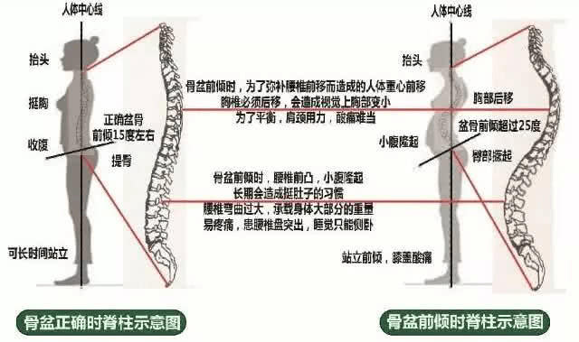 当骨盆的上前部向前,向下倾斜,而坐骨和尾骨被上提时,骨盆便处于前倾