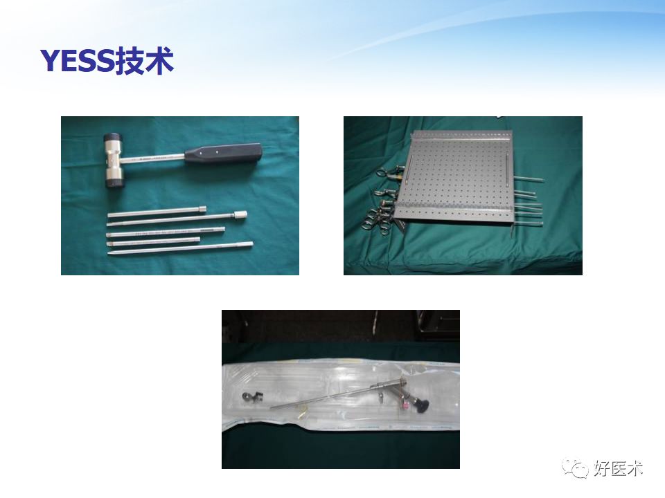 椎间孔镜技术的操作技巧及要点