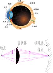 科普：眼球成像！的图1