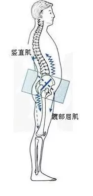 肋骨变形怎么办