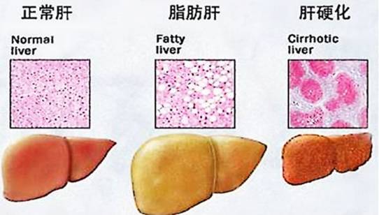 肝部疼痛怎么办