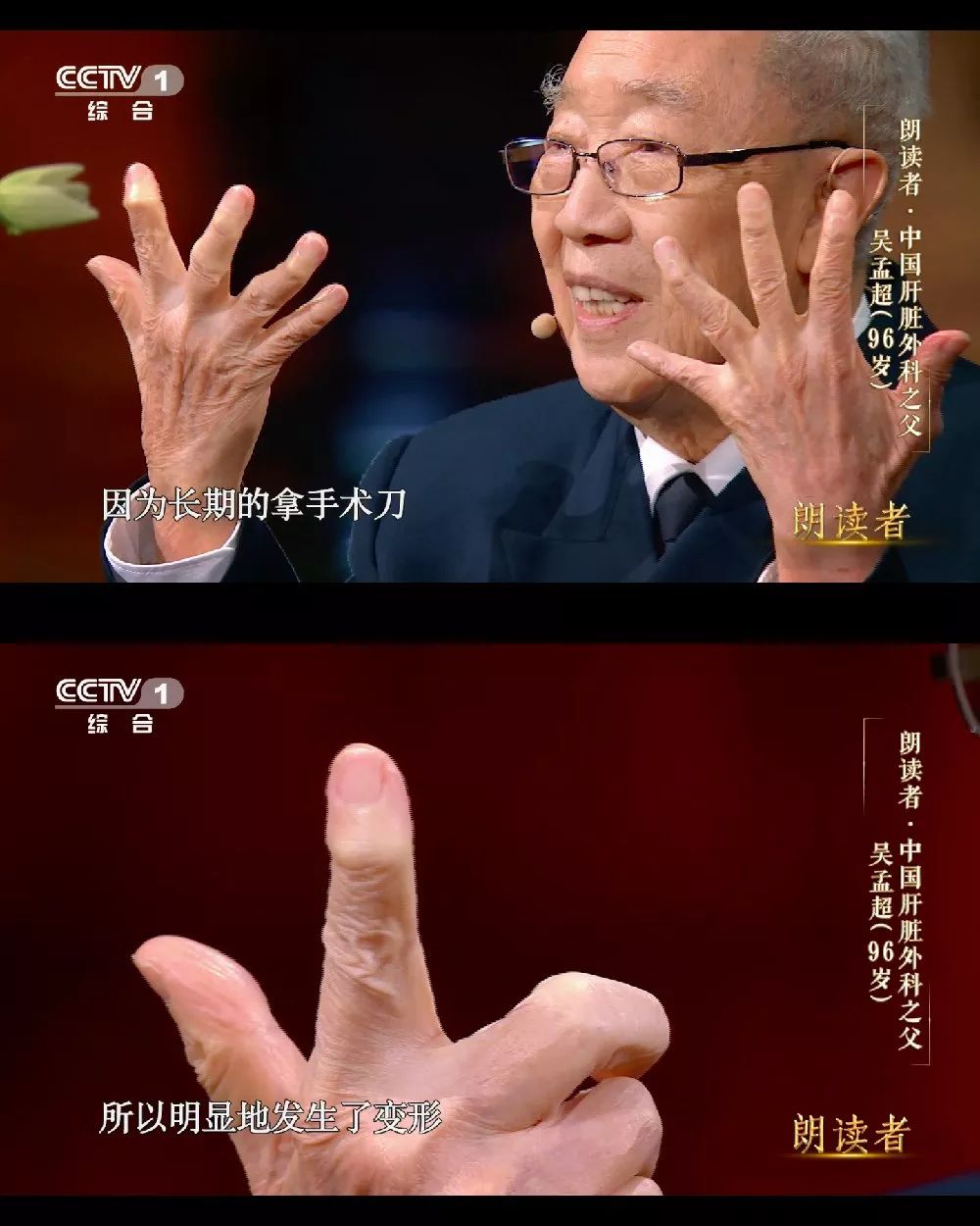 96歲泰鬥仍每周3台手術，一封信讓董卿當場落淚！網友也哭慘了... 娛樂 第3張