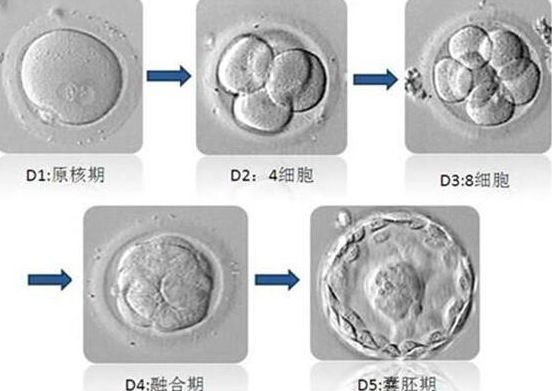 试管婴儿什么情况下适合养囊胚囊胚移植优势是什么