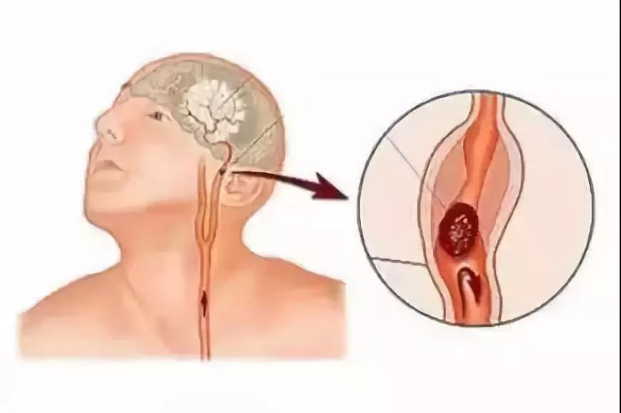 人口手足_人口手足(3)