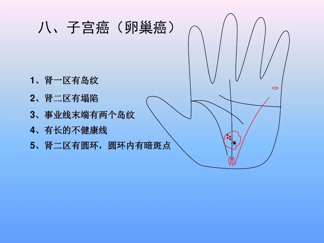 最全手诊图谱(非常实用)