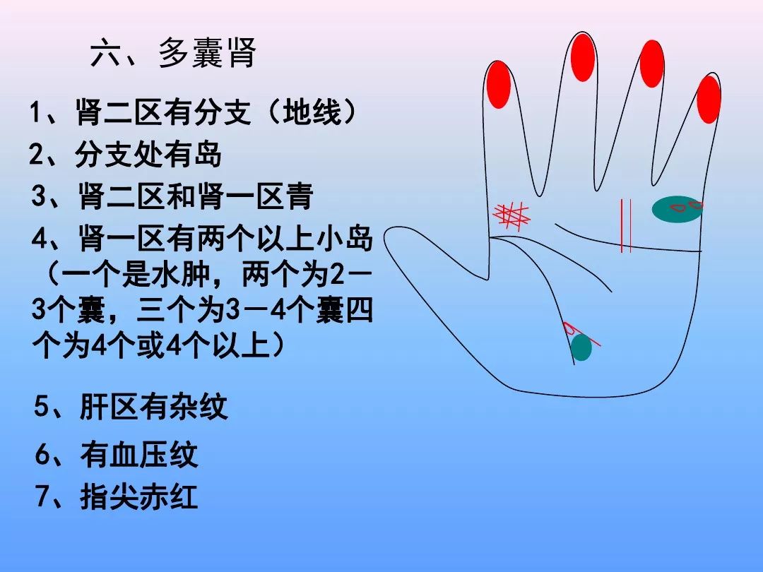 最全手诊图谱非常实用