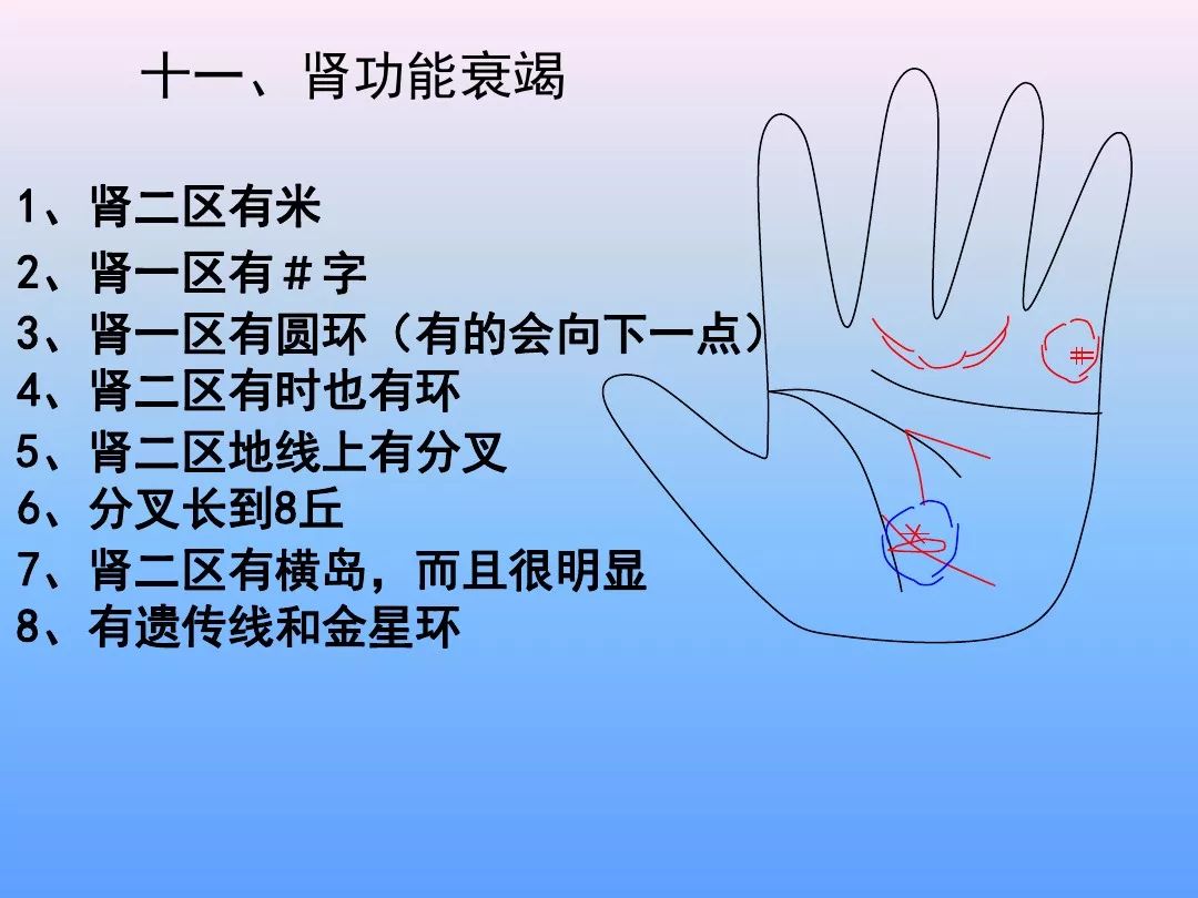 最全手诊图谱非常实用