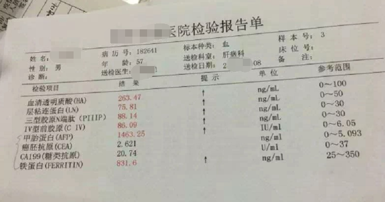 睡觉时出现这3种痛感,别迟疑,赶紧测甲胎蛋白,确诊是否是肝癌