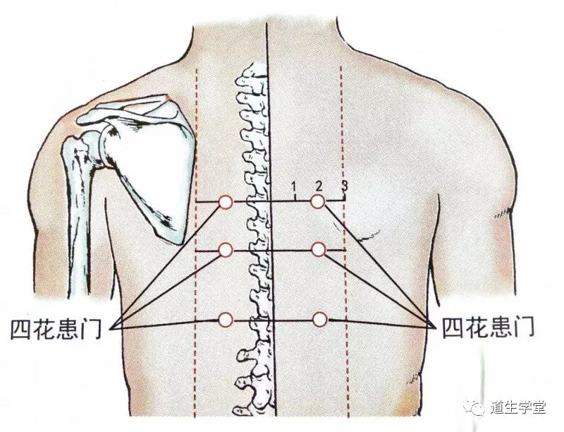 经外奇穴|四花患门