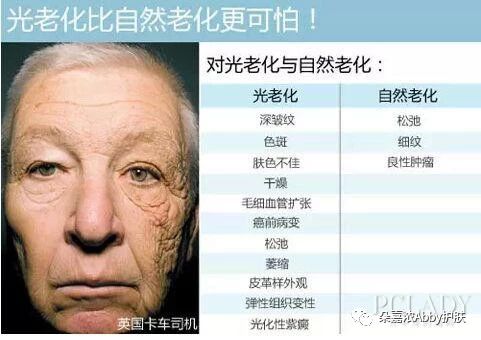 光生物学特征与皮肤光老化