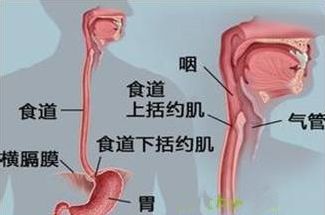 反流物攻击并损伤食管黏膜 (1)抗反流屏障胃和食管交接部解剖结构——