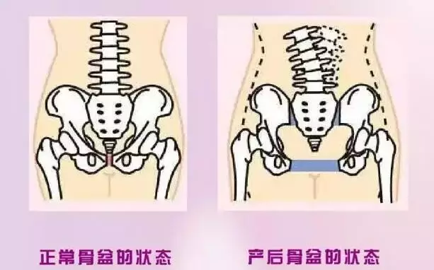 『产后那些事儿』还没找到让你一身赘肉,浑身疼痛的