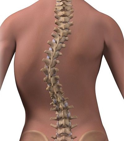 青少年特发性脊柱侧凸(弯)是青少年最常见的脊柱畸形,发病率约2-3%