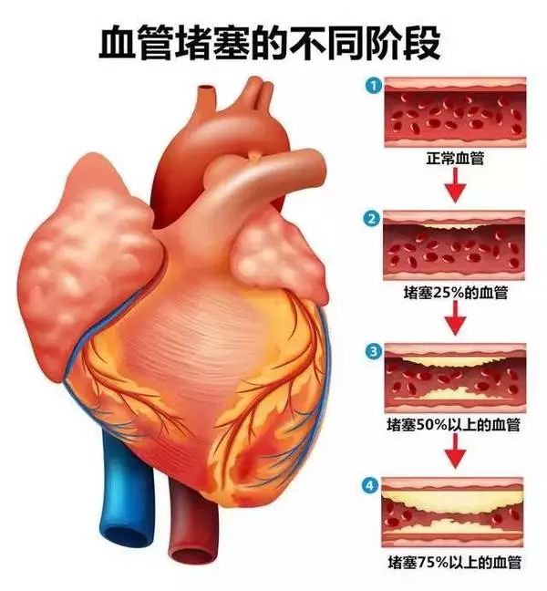 一种蘑菇可泡水喝,喝一喝,高血脂,血管垃圾,动脉硬化统统不见