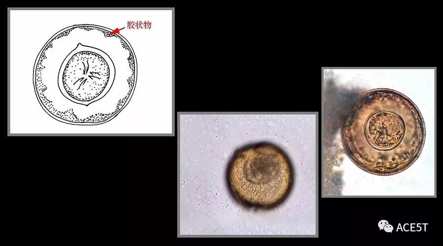 缩小膜壳绦虫卵