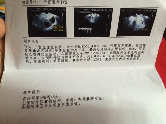 2,检查胎芽和胎心 3,测量crl,推算预产期 4,查看nt值 这个阶段检查nt