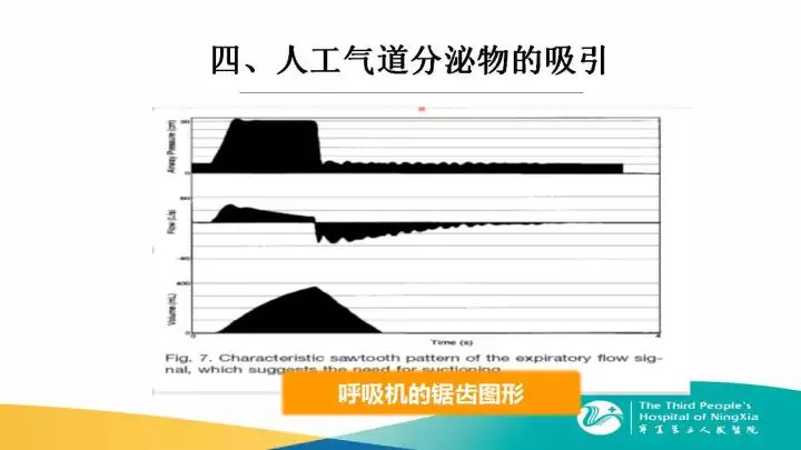 四種方法教會你做好人工氣道的管理！ 生活 第30張