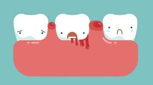 牙龈肿痛牙龈出血怎么办