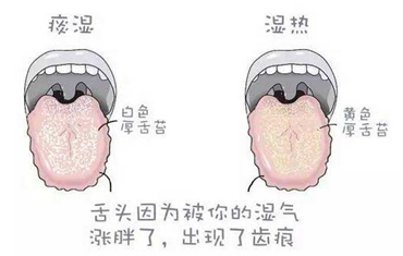 如果你经常便秘,且口苦口臭,舌苔厚,舌质红,尿黄,中医辨证属于"胃火