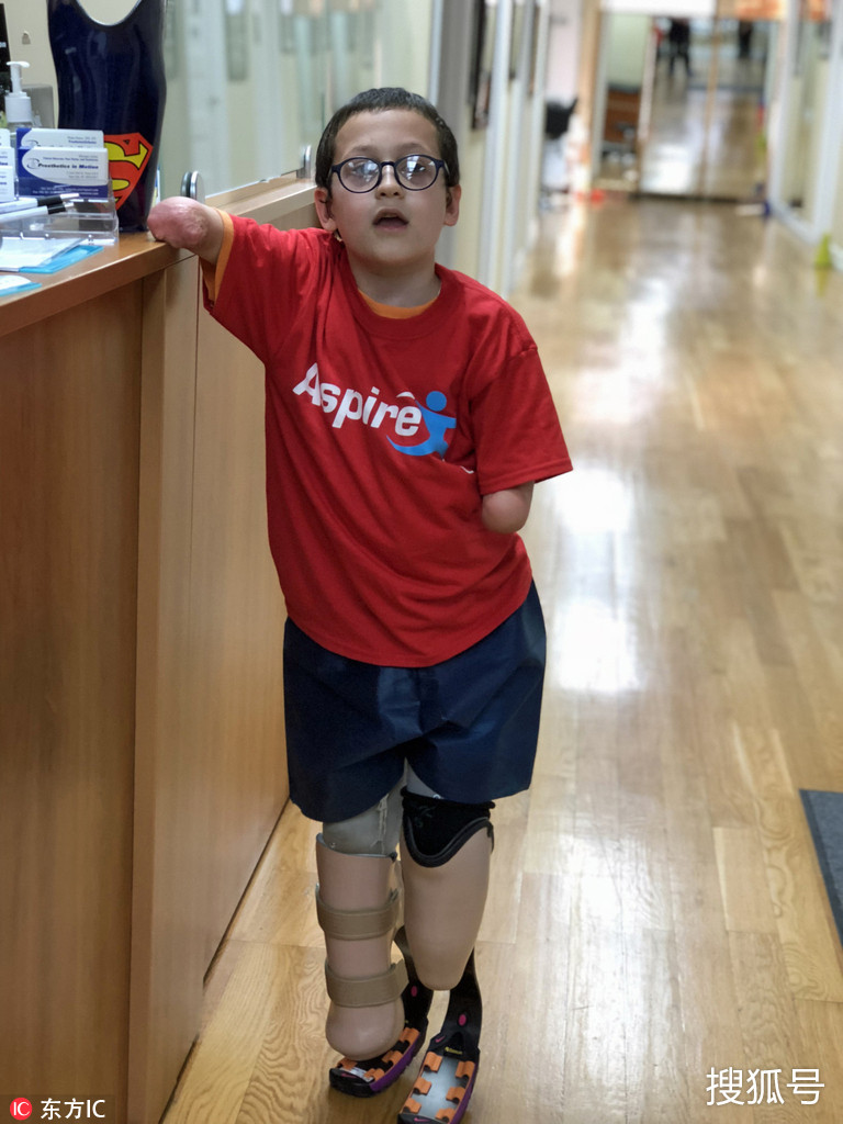 小男孩患脑膜炎截肢无手无脚 穿戴假肢首次奔跑