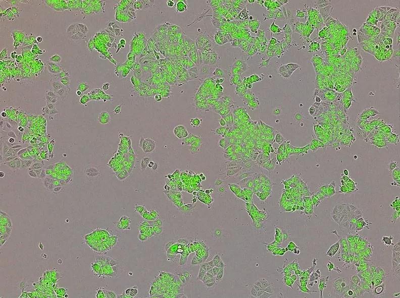 人类乳腺癌细胞(细胞核呈绿色).来源:伦敦帝国理工学院