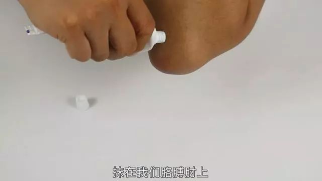 胳膊上有黑色素怎么办